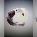 Cirujanos Argentinos Crearon La Primera Mascara 3d Para Reconstrucción Facial