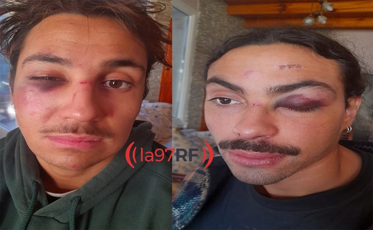 golpiza maldito ibiza